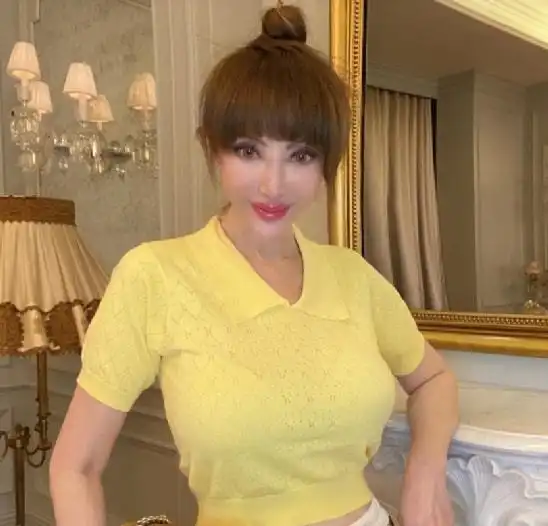 6位老年整容脸女星,个个脸部僵硬,笑跟哭一样