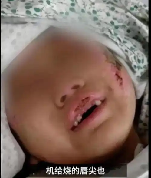 执业24年中最残忍的虐童案,孩子隐忍与亲属失察的3点反思