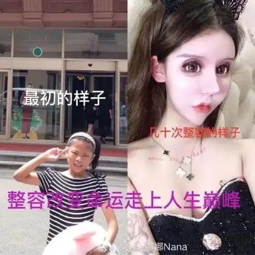 我花了100万,把女儿整成了残废新学期扎堆整容