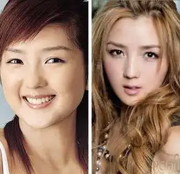 前快女整容成畸形锥子脸选秀歌手疑整容