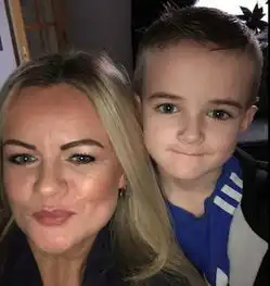 爱尔兰女子让无证美容师打针丰唇,结果打进动脉导致嘴巴奇肿无比