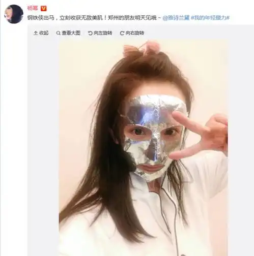 大幂幂发际线又上热搜,大批女明星都有秃顶之忧