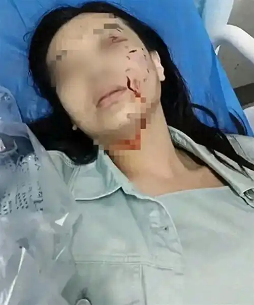 女童母亲再发声黑犬已找到,孩子重伤无法探视,保洁救人应点赞