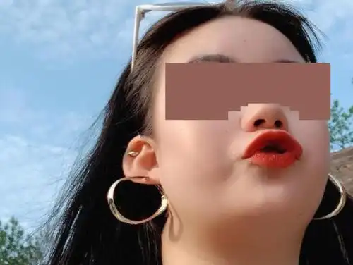 23岁女孩网贷3万元隆鼻,整容后鼻子短了一截,整形机构改名拒绝赔偿