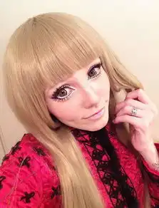 美女孩因患肌萎缩症变真人版芭比娃娃