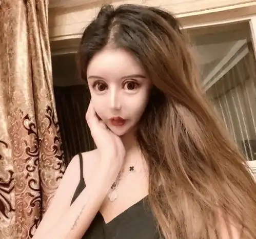 13岁少女整容上瘾,砸100万手术60次,三年前后判若两人