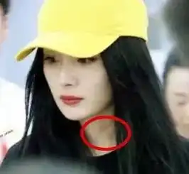 啊啊学杨幂放血却背后烧出7个大洞另一无脑女星同做项目堪比剥皮效果...