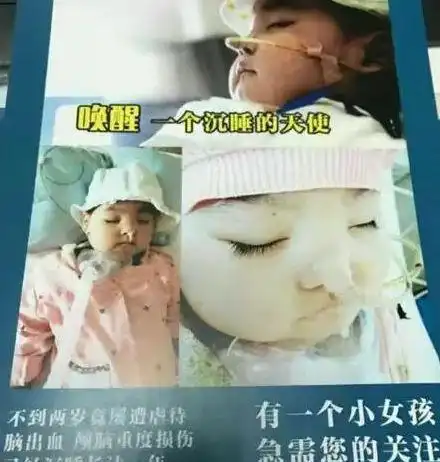 15年一岁女童被妈妈情人虐待,妈妈目睹却未制止,致女童昏迷多年