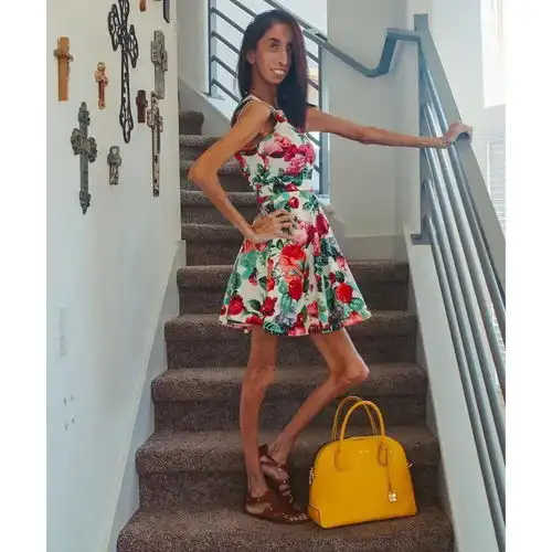 她被骂全世界最丑的女人,却教会千万人美是什么