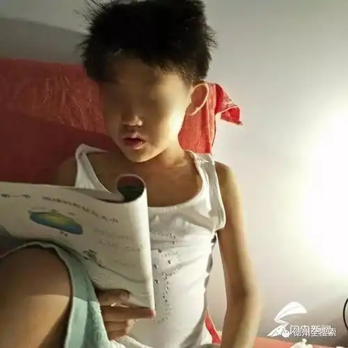 德州12岁女孩患重病仍坚持学习称不怕病痛就怕课程落太多