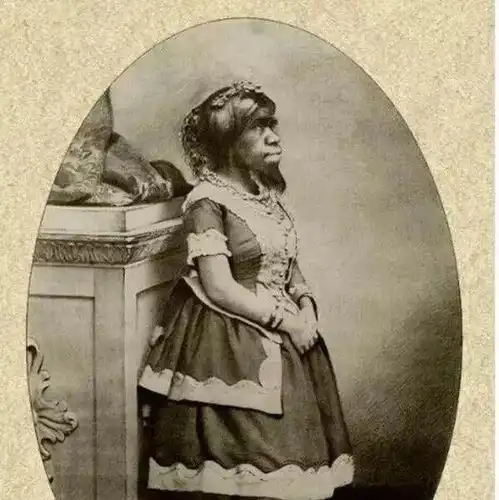 世界上最丑的女人,生前被当怪物,死后遗体被丈夫展览100多年