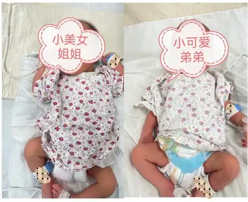 32岁女子患乳腺癌,38次放化疗后保住乳房并诞下龙凤胎
