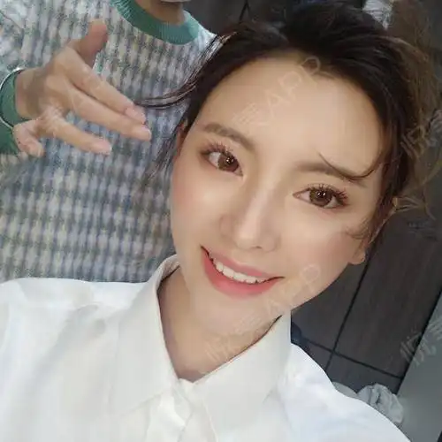 前两天看到一个wsc骑电动车载着一个美女的视频,看到...磨骨悦美整形