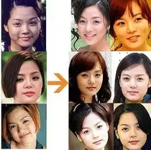 揭明星整容后遗症硅胶女神李颖芝毁容