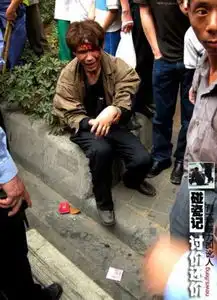 男子碰瓷遭医生拆穿倒地抽搐都救你好多回奇葩碰瓷现场图