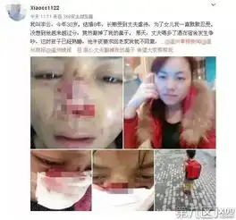你的鼻子好看会吸引人丈夫拿起修眉刀把她的鼻子割了嘉兴第9区