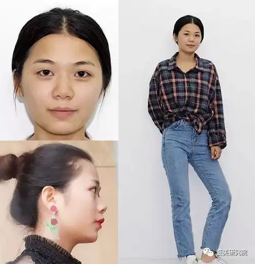 荐号丨突嘴肉鼻女孩,改完即刻女团出道