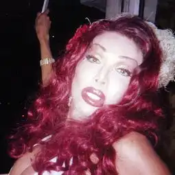 变性女整形胸部成畸形