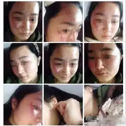 湖北一女教师与女生互殴不疯狂不奇葩的还是女人吗