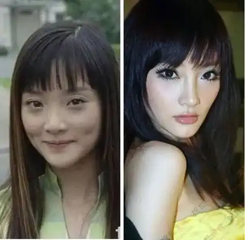 明显整过的脸,为什么医生鉴定不出来