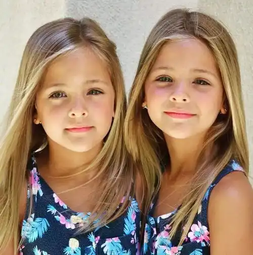 据说,她们是世界上最美的双胞胎