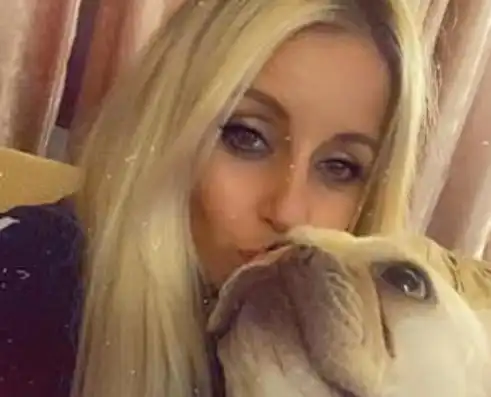 英国女子被宠物狗咬伤,几天后发展为败血症,器官衰竭双手截肢