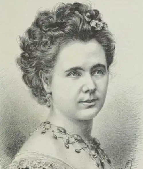 被称为最丑的女人高138㎝,一生被当成摇钱树,死后被制成标本