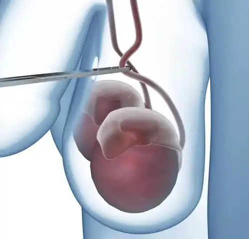 男人不喜欢戴套男性避孕药人体试验成功这下终于要轮到男人...