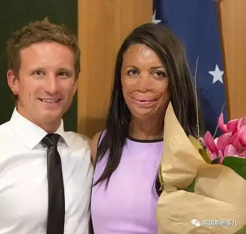 她曾是模特,却被大火毁容...但她有个视颜值如粪土的男朋友,不离不弃