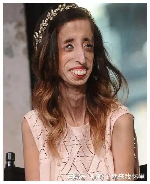 被称为世界上最丑的女人却逆袭成人生的大赢家