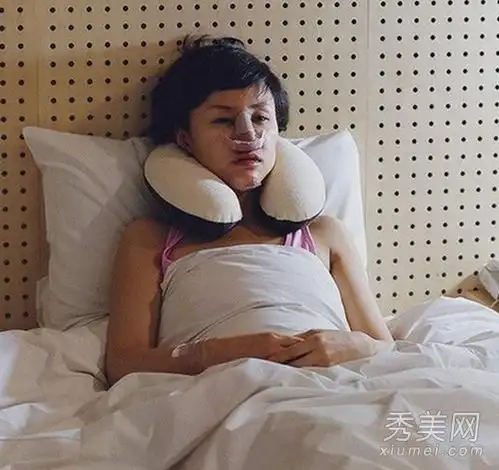 摄影师追踪整形手术后韩国女性的恐惧