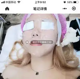 惊了大s无处安放的少女感源自台湾的皮秒镭射净肤无针水光只要399,与女明星一起冻龄
