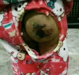 砀山虐童案开庭女童曾遭生母开水烫手伤口撒盐