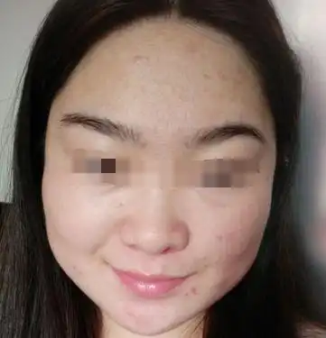 注定一生婚姻不幸的女人面相
