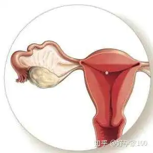 35岁女人试管婴儿前如何调理卵巢,增加试管婴儿成功率