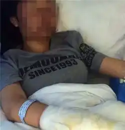 安徽临泉一中在职老师校外补课补课学生险遭毁容