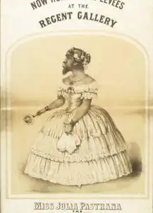 世界上最丑的女人拒绝了20多个追求者,一生都被当成摇钱树