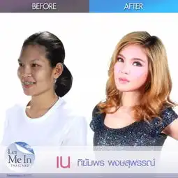 丑到受排挤的他,整容变花美男,和变性女友相拥而泣