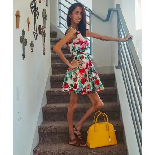 她被骂全世界最丑的女人,却教会千万人美是什么