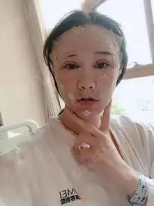 在我们女生眼里女生可以分为,高冷型女神型萌妹子...双眼皮悦美整形