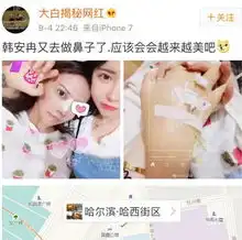 她说活到老整到老,隆鼻4次,从叛逆少女变成流量网红