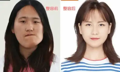 歪脸女为梦想整容,拒绝百万年薪当网红,只为站上三尺讲台