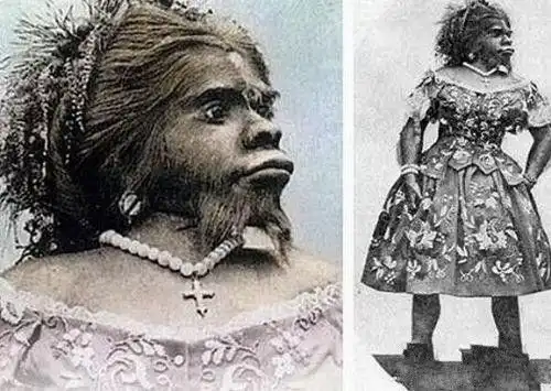 世界最丑的女人,一生被当作摇钱树,死后还被丈夫制成标本赚钱