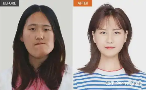 迷死氧看脸歪脸女孩重获新生