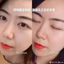 惊了大s无处安放的少女感源自台湾的皮秒镭射净肤无针水光只要399,与女明星一起冻龄