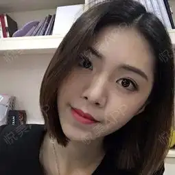 大家快看发现美女一名嘞,有事没事就开始玩起了自拍...开眼角悦美整形