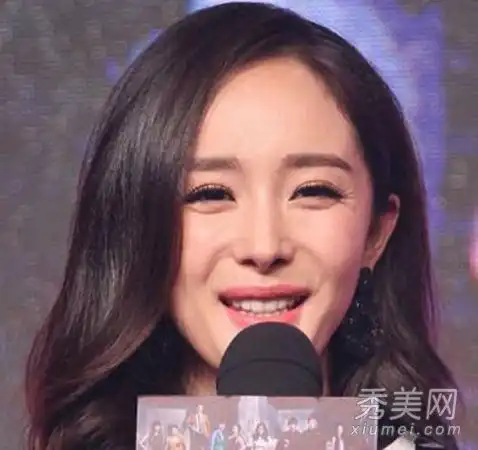 26岁的杨蜜鱼尾纹暴露眼睛细纹怎么保养