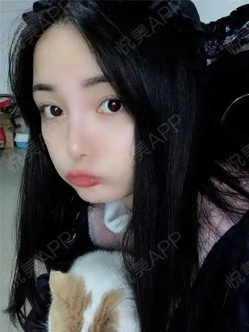 今天是嘟嘴卖萌的一天,哈哈,女生呐总是有一颗少女心...双眼皮悦美整形