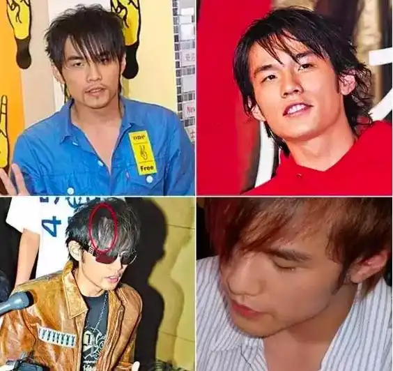 胡歌发际线比爱心,杨幂说请珍惜她的头发,明星也难逃秃顶脱发