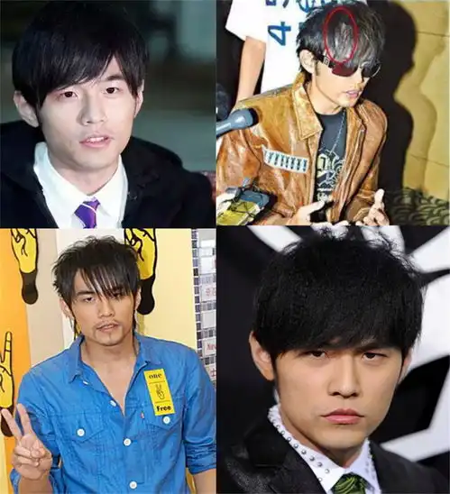 天王也脱发周杰伦一直戴帽子的原因找到了,假发片还能拯救他吗